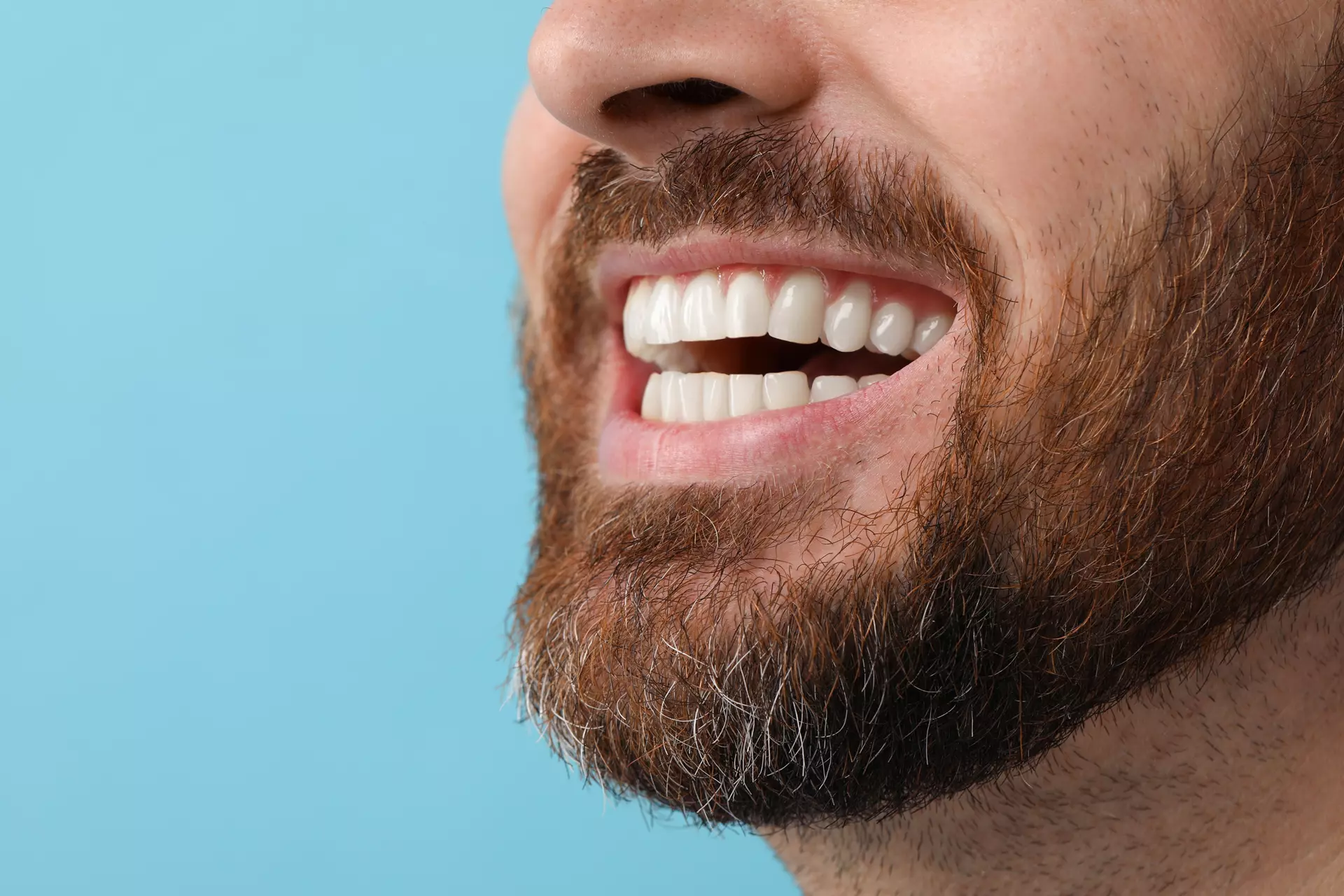 Sinus Augmentation